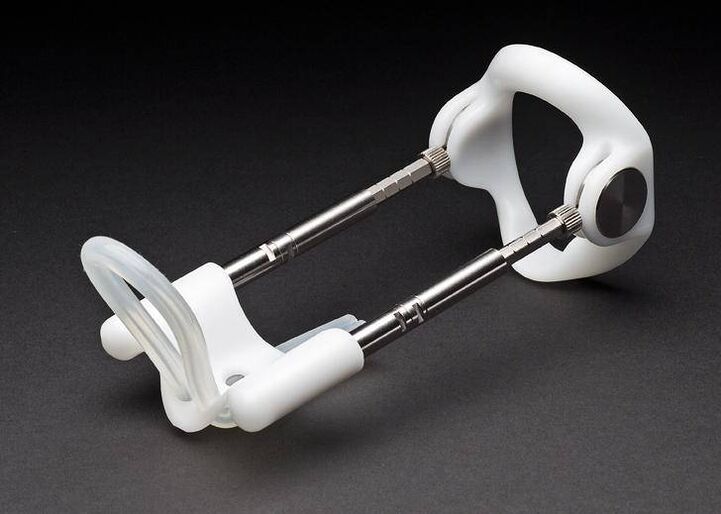 Estensore dopo l'intervento chirurgico di ingrandimento del pene